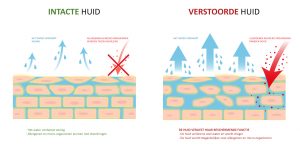 aczeem verstoorde huidbarriere huidproblemen